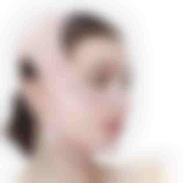 Lente sejas liftingam un žokļa līnijas veidošanai | KIMLIFT